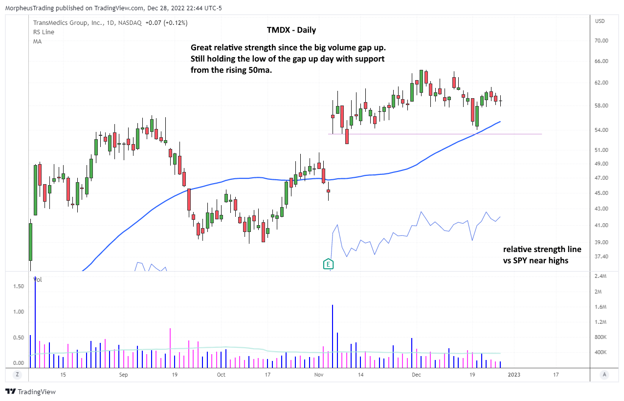 $TMDX DAILY